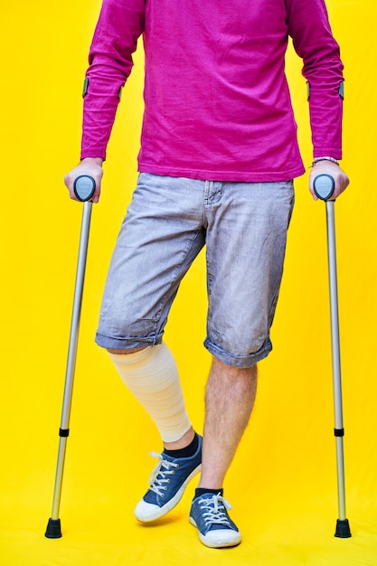 Photo unrecognizable man from the front wearing a purple shirt shorts and on crutches, with a bandaged leg.