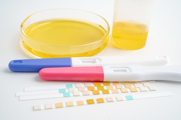Urinalysis pregnancy test and urine cup with reagent strip pH paper test in laboratory contraception health and medicine