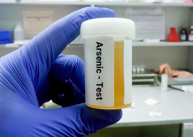 Urine sample for arsenic test for the diagnosis of arsenic toxicity