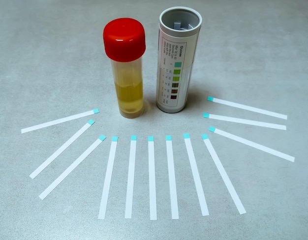 Urinemonster, teststrip met fles geïsoleerd voor urine glucose (suiker) testen