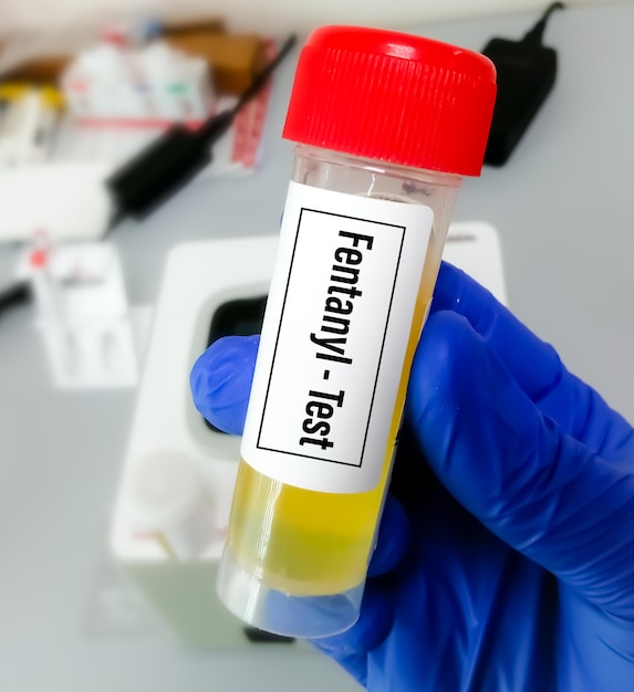 Foto urinemonster voor fentanyl-drugstest