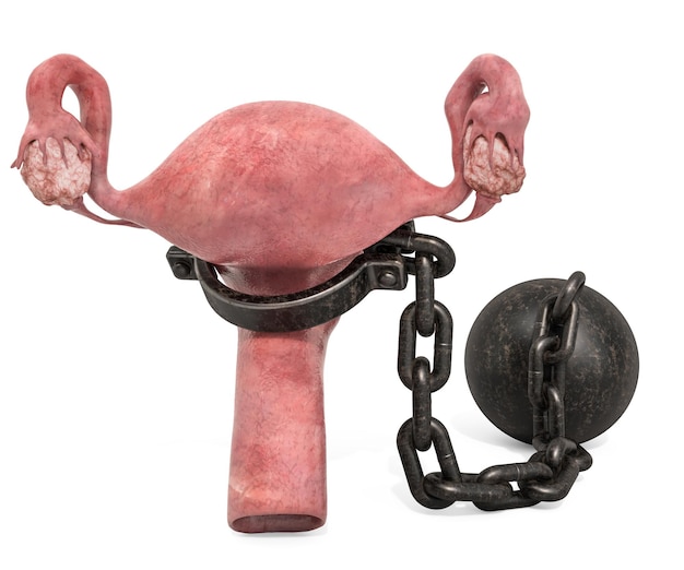 Photo uterus disease concept human uterus with shackle 3d rendering