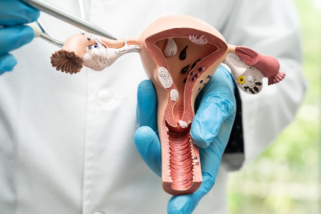 Uterus doctor holding anatomy model for study diagnosis and treatment in hospital