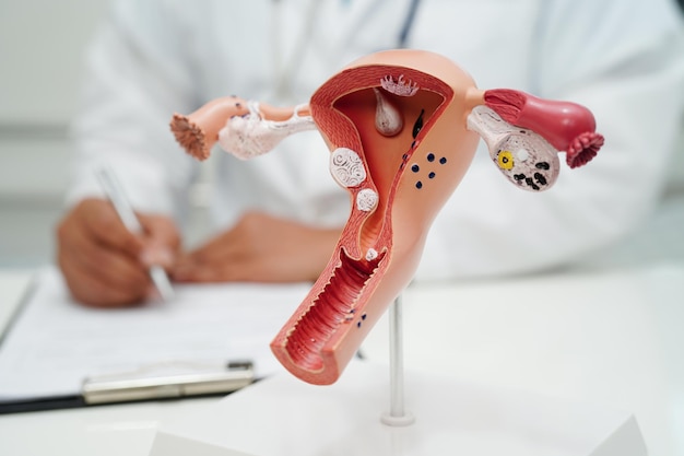 Uterus doctor holding human anatomy model for study diagnosis and treatment in hospital