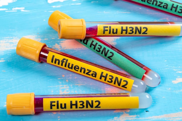 Foto tubo sottovuoto per la raccolta del sangue scritto flu h3n2 in riferimento al tipo di influenza