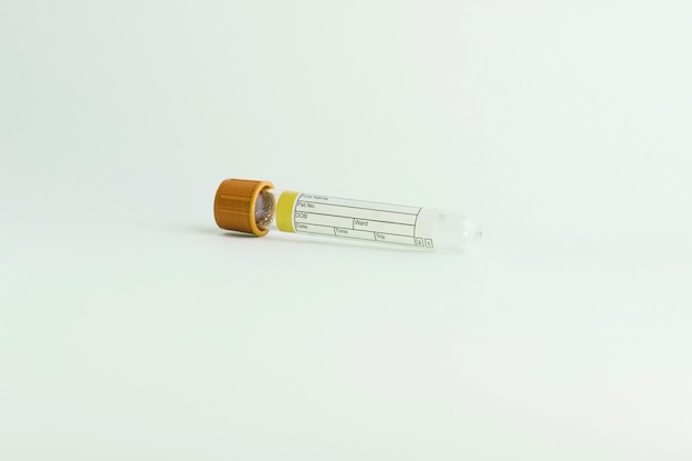 Vacuum tube for collection and blood samples on white background
selective focus