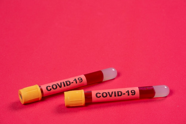 Vacuum tube with blood and the word covid-19 on the identification tag