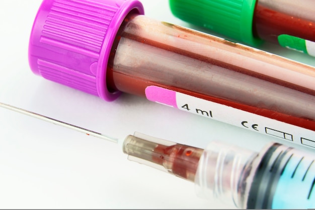 vacuum tubes for collection and blood samples and a syringe isolated on background selective focus