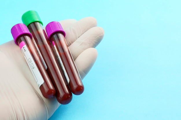 vacuum tubes for collection and blood samples and a syringe isolated on background selective focus