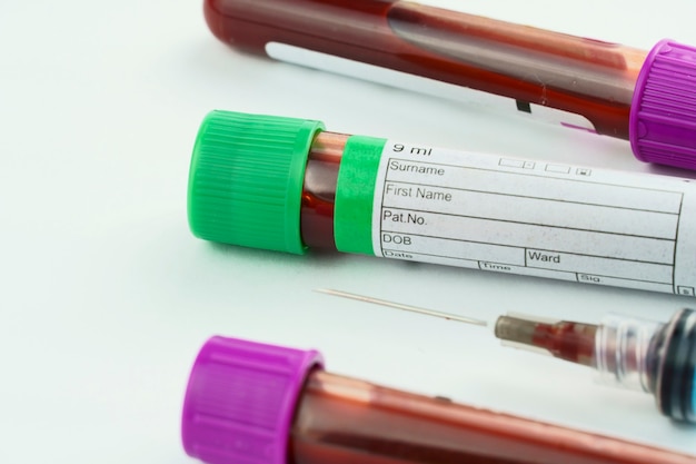 vacuum tubes for collection and blood samples and a syringe isolated on background selective focus