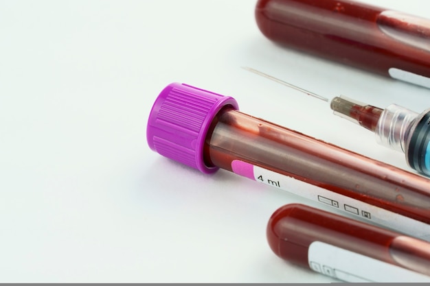 vacuum tubes for collection and blood samples and a syringe isolated on background selective focus