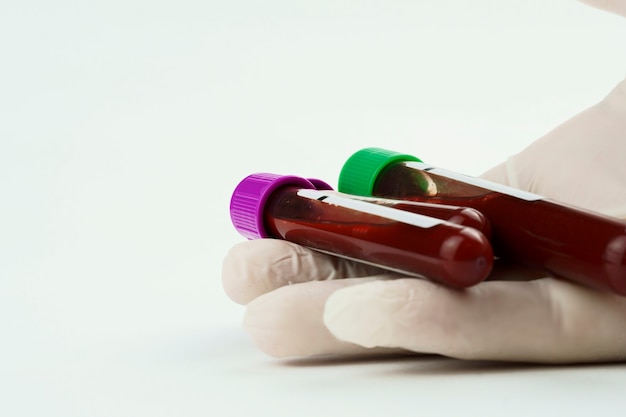 вакуумные пробирки для сбора и образцов крови и шприц, изолированные на фоне выборочный фокус