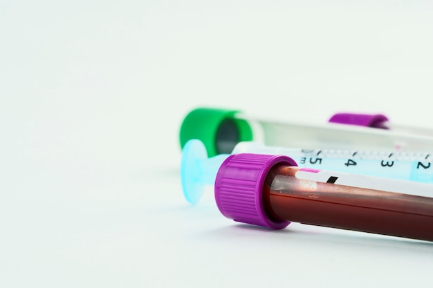 Vacuum tubes for collection and blood samples and a syringe on white background. Transparent tubes with purple and green lid. Label to identify the data. Selective focus.