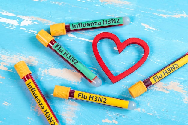 Vacuümbuis voor bloedafname geschreven FLU H3N2 met verwijzing naar het grieptype