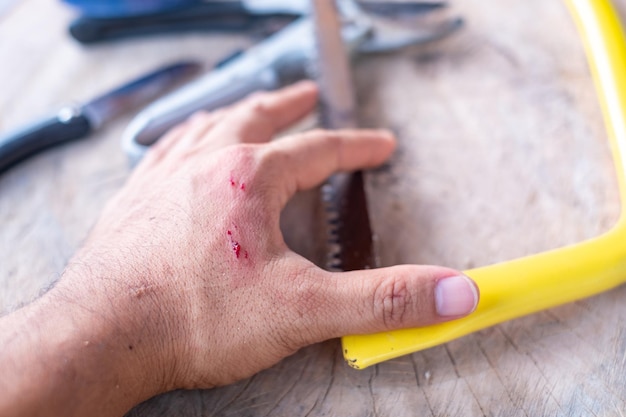 Vakman's hand met bloedende wond Gereedschapsongeval tijdens het werken verzekeringsongeval riskant beroepsrisico
