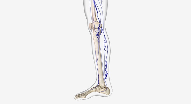 Varicose veins in human leg