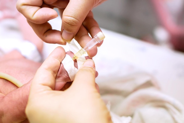 Verpleegkundige handen gebruiken medische hechtpleister en wikkelen veilig op de IV-katheter en de hand van de zieke pasgeboren baby om de zoutoplossing en het medicijn voor te bereiden