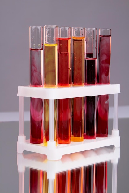 Vertical shot of colorful laboratory test tubes with blood