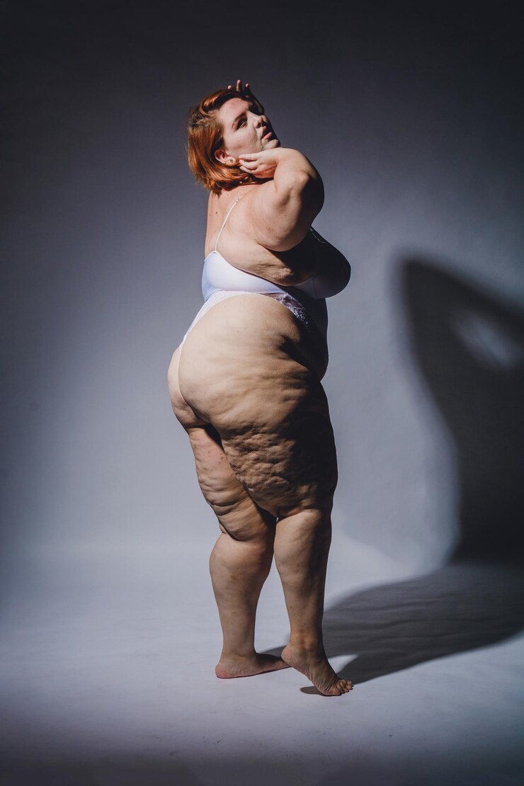 verticale afbeelding van plus grootte blanke vrouw in lingerie met cellulite poseert zelfverzekerd hard licht