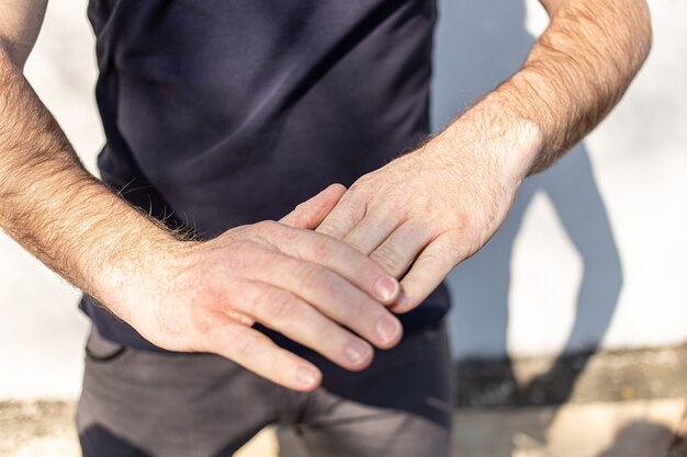 Photo very dry hands touching, peel due to washing alcohol