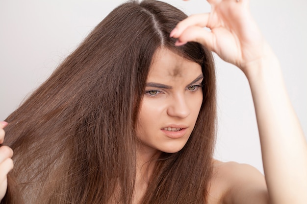 Very upset young woman has a problem with hair loss