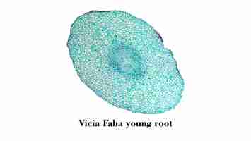 Photo vicia faba root micrograph