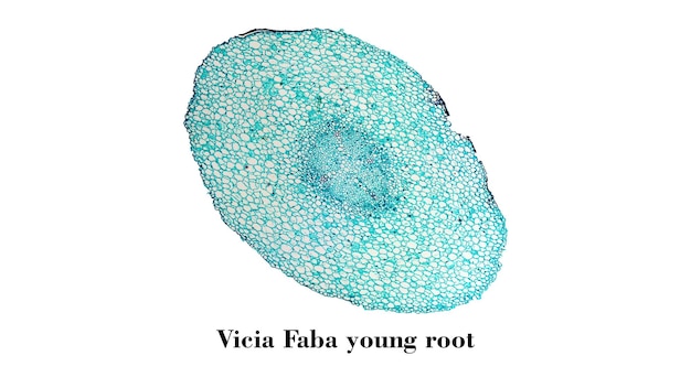 Vicia faba wortel microfoto