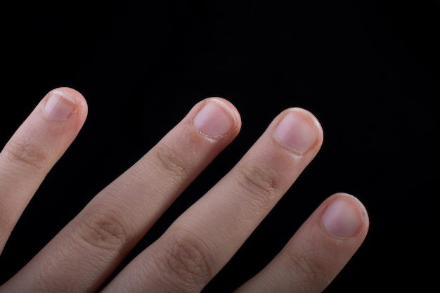 Vier vingers van een menselijke hand gedeeltelijk in beeld