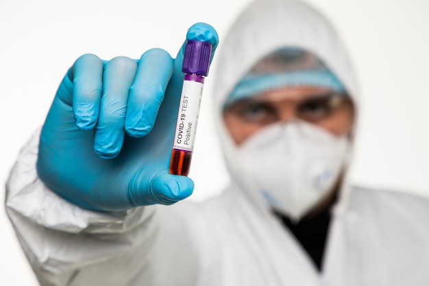 Virologist in a medical mask and protective clothing holds a test tube with positive blood sample for coronavirus testing. Pandemic covid19. Respiratory syndrome, panic, experiences, research