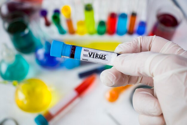 Foto tubo di prova del sangue virale in vasi da laboratorio e reagenti in laboratorio