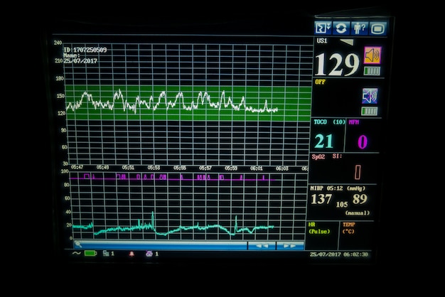 Vital Signs Monitor