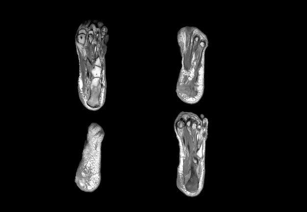 Voet-MRI en ct-scan xray-afbeelding