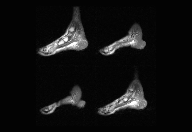 Voet-MRI en ct-scan xray-afbeelding