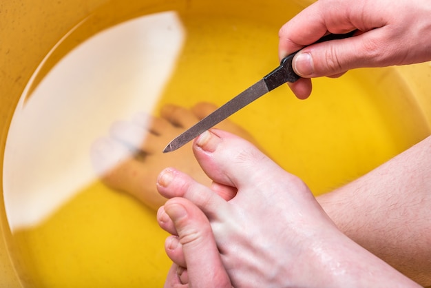 Voetbaden. Verzorging van huid en nagels op voeten en hielen. Vijlen van de teennagels.