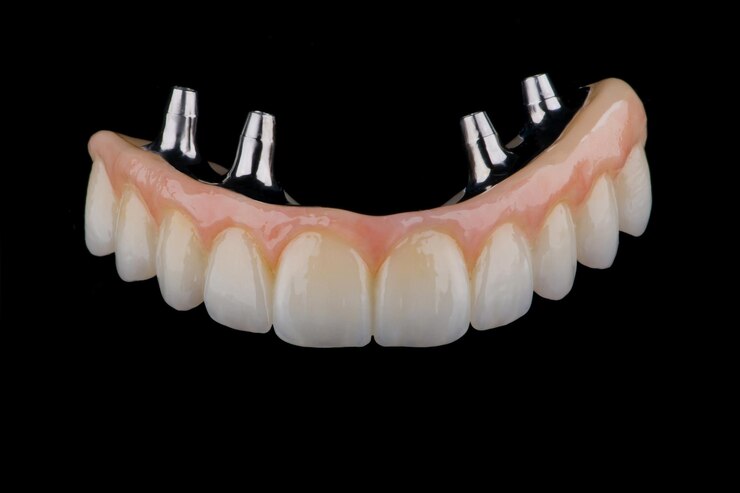 Volledige tandprothese van zirconium op een titanium staaf gekleurd met vlekken voor keramiek