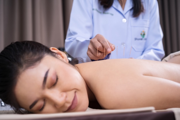 Vrouw die acupunctuurbehandeling op rug ondergaat