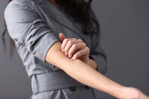Vrouw krabt haar handmanifestatie van neurosenconcept