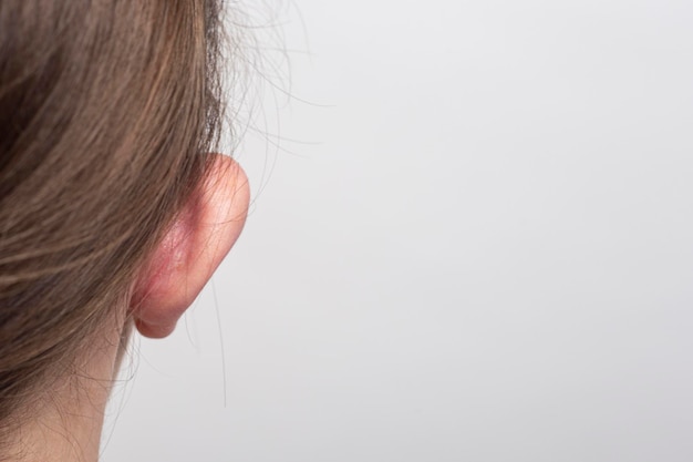 Vrouw met hangende oren uitpuilend oor achteraanzicht op een lichte achtergrond. Otoplastiek, kunststof van de oorschelp.
