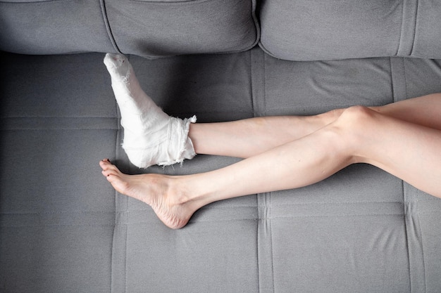 Foto vrouw met mooie lange benen en een gips op haar rechterbeen met krukken ligt op de bank top view