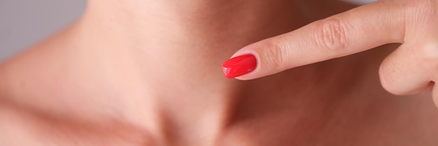 Vrouw met rode manicure wijzende vinger op nekgebied met schildklierclose-up