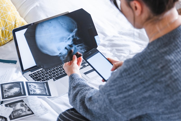 Vrouw met röntgenfoto van hoofd met telefoon in de hand laptop met witte scherm medische resultaten op achtergrond