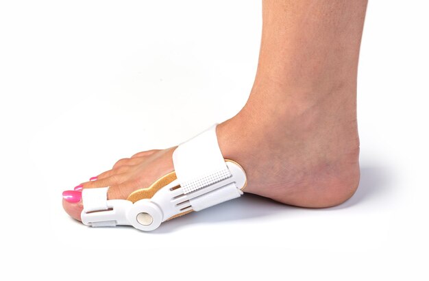 Vrouw voeten met orthopedische pads geïsoleerd op white