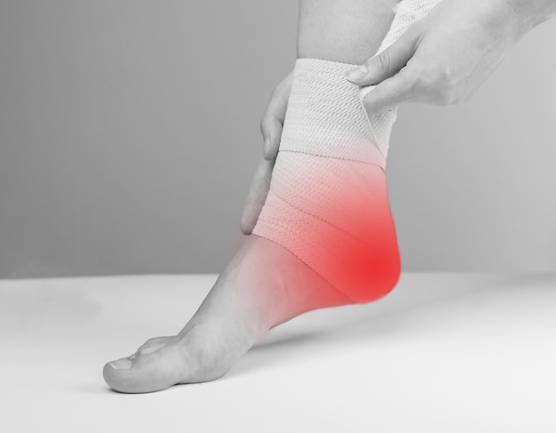 Vrouw wikkelt elastisch verband rond pijnlijke enkel om hielpijn en ontsteking te verminderen Voeten met rode vlek Plantaire fasciitis tendinitis behandeling Gezondheidszorgconcept Zwart-wit