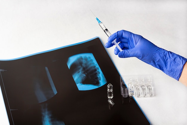 Vrouwelijke arts hand in handschoen houdt een spuit met vaccin tegen röntgenfilm (scan) van longen