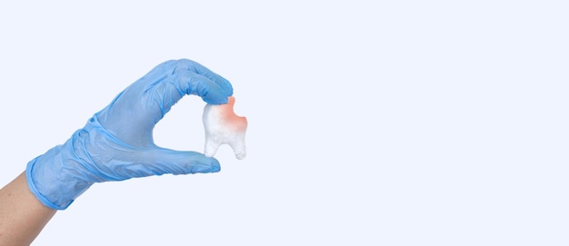 Vrouwenhand die ongezond tand wit kiesmodel op pastelblauwe achtergrond houden Het teken van het tandsymbool