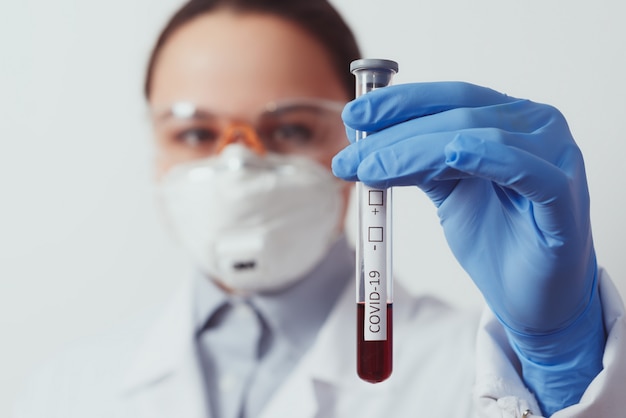 wetenschappelijk bedrijf Corona Virus Blood Test Tube