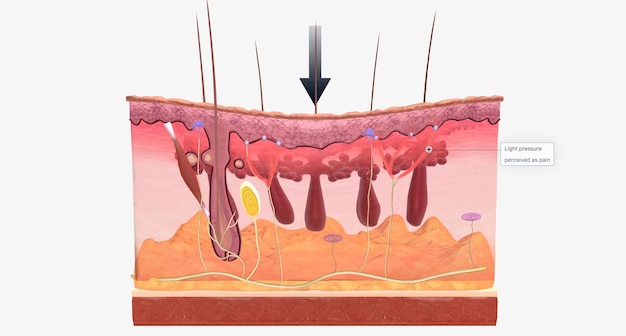 Photo with fibromyalgia nerves become hypersensitive to external stimuli a change known as central sensitization