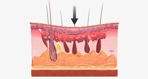 Photo with fibromyalgia nerves become hypersensitive to external stimuli a change known as central sensitization