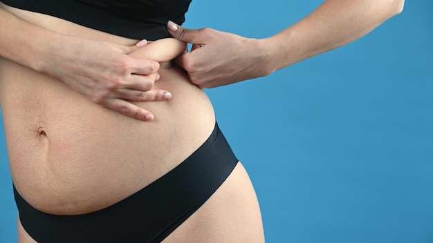 Woman in black underwear touches excess skin on her back and waist The problem of obesity and lack of sport