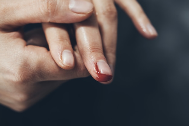 Woman bloody finger